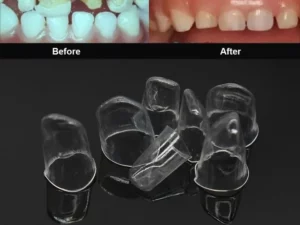 64pcs Dental Anterior Transparent Crowns