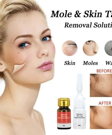 Mole & Skin Tag Removal Solution
