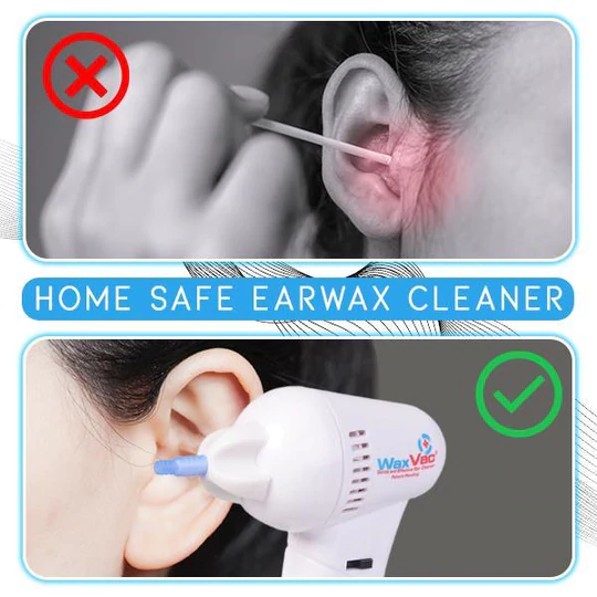 e-Clean™ Ear Wax Auto Vacuum Remover