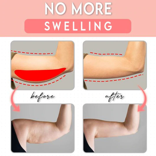 MediBeauty™ Lymph Active Massage Arm Sleeve