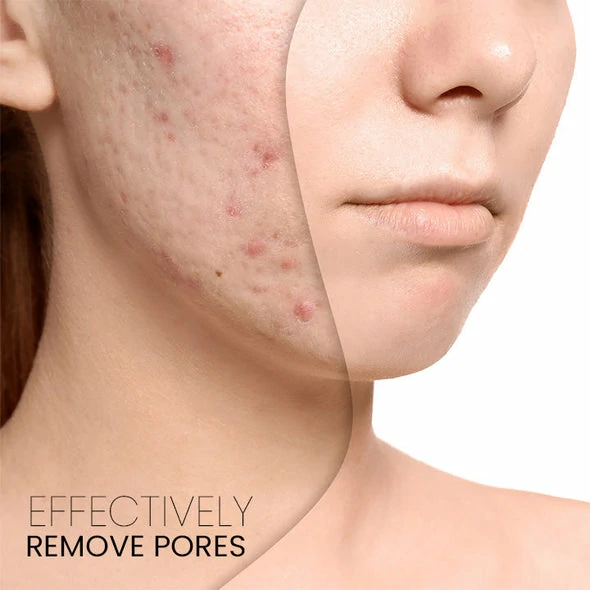 PoresClear Centella Cooling Mask