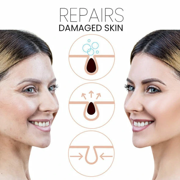 PoresClear Centella Cooling Mask