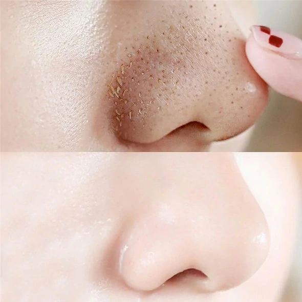 PoresClear Centella Cooling Mask