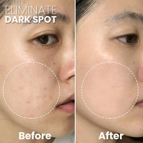 PoresClear Centella Cooling Mask