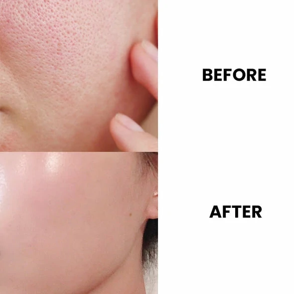 PoresClear Centella Cooling Mask