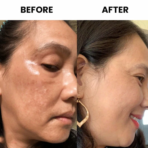 PoresClear Centella Cooling Mask