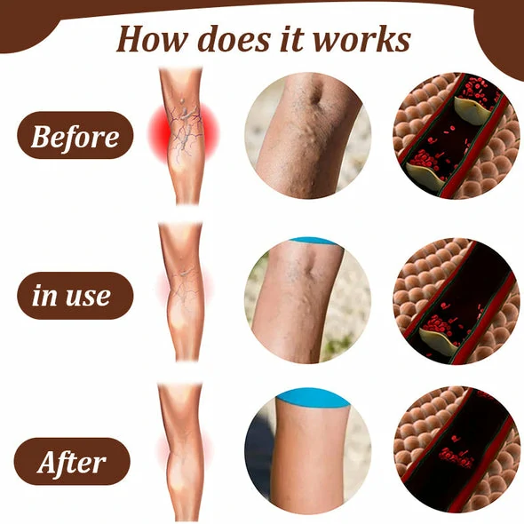 LegVeins hữu cơPatch