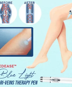 Medease™ Blue Light Vari-Veins Therapy Pen