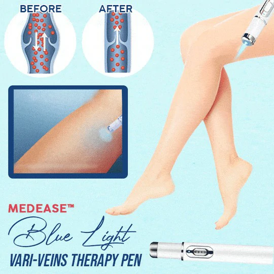 Medease™ Blue Light Vari-Veins Therapy Pen