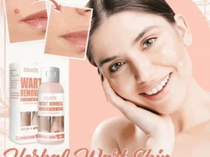 Herbal Wart Skin Removal Ointment