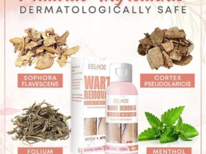 Herbal Wart Skin Removal Ointment