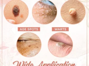 Herbal Wart Skin Removal Ointment