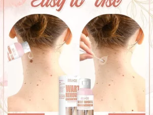 Herbal Wart Skin Removal Ointment