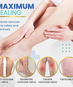 BeauSkin Spider Veins Repair Cream