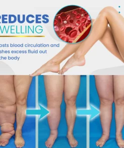 BeauSkin Spider Veins Repair Cream