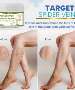 BeauSkin Spider Veins Repair Cream
