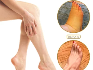 LymphaticDrainage Detoxification GingerOil