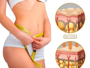LymphaticDrainage Detoxification GingerOil