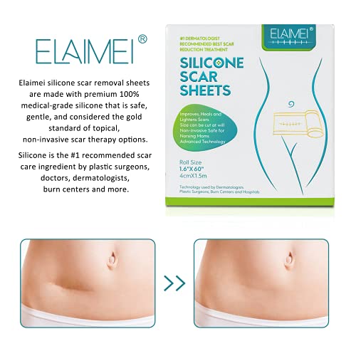 ELAIMEI™ Medical Soft Silicone Gel Tape bakeng sa Ho Tlosa Scar (1.6" x 60")