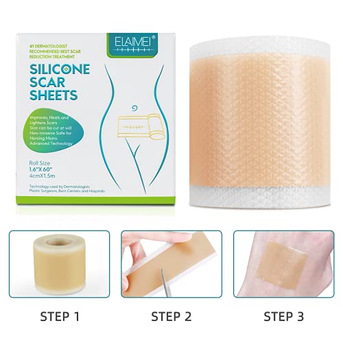 ELAIMEI™ Medical Soft Silicone Gel Tape for Scar Removal (1.6” x 60”）