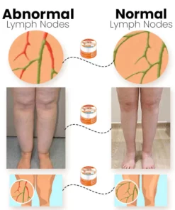 LymphaticPro™ Lymph Nodes Herbal Detox Cream