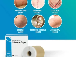 MEDICAL SOFT SILICONE GEL TAPE FOR SCAR REMOVAL