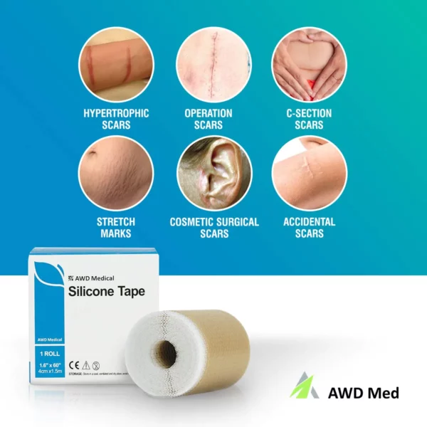 MEDICAL SOFT SILICONE GEL TAPE FOR SCAR REMOVAL