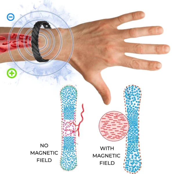 Gelang Terapi Osteoporosis SMF