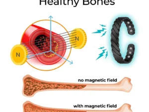 SMF Osteoporosis Therapy Bracelet