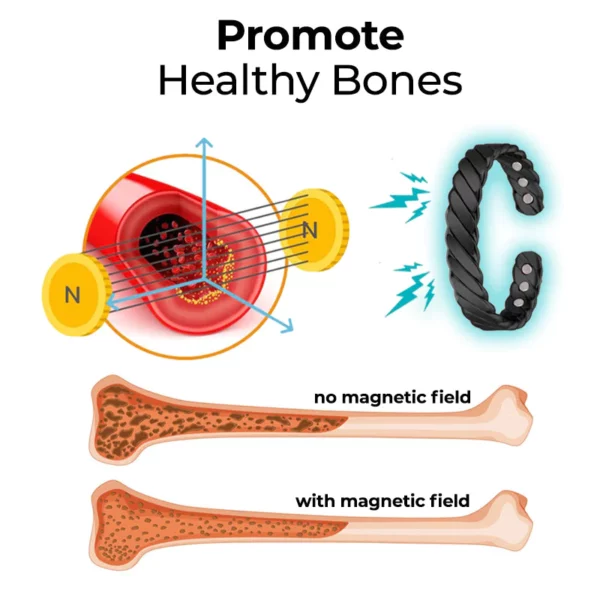 SMF osteoporose terapi armbånd