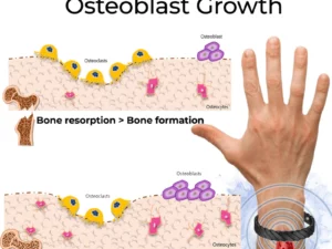 SMF Osteoporosis Therapy Bracelet