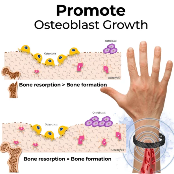 Bangili ya Tiba ya Osteoporosis ya SMF