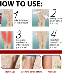 Varicose Veins Relief Cream