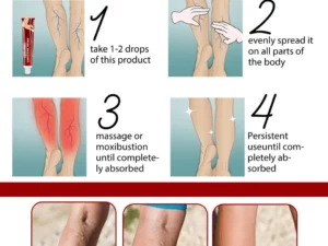 Varicose Veins Relief Cream