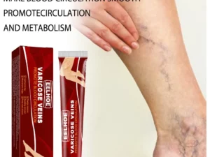 Varicose Veins Relief Cream