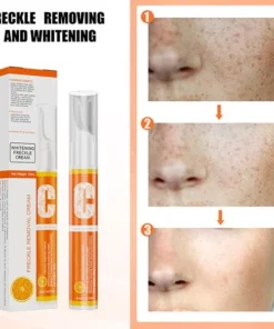 Vitamin C Freckle Dark Spot Removal Cream