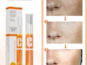 Vitamin C Freckle Dark Spot Removal Cream