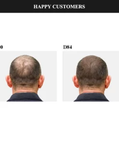 CKTUING HAIR GROWTH SERUM 2.0