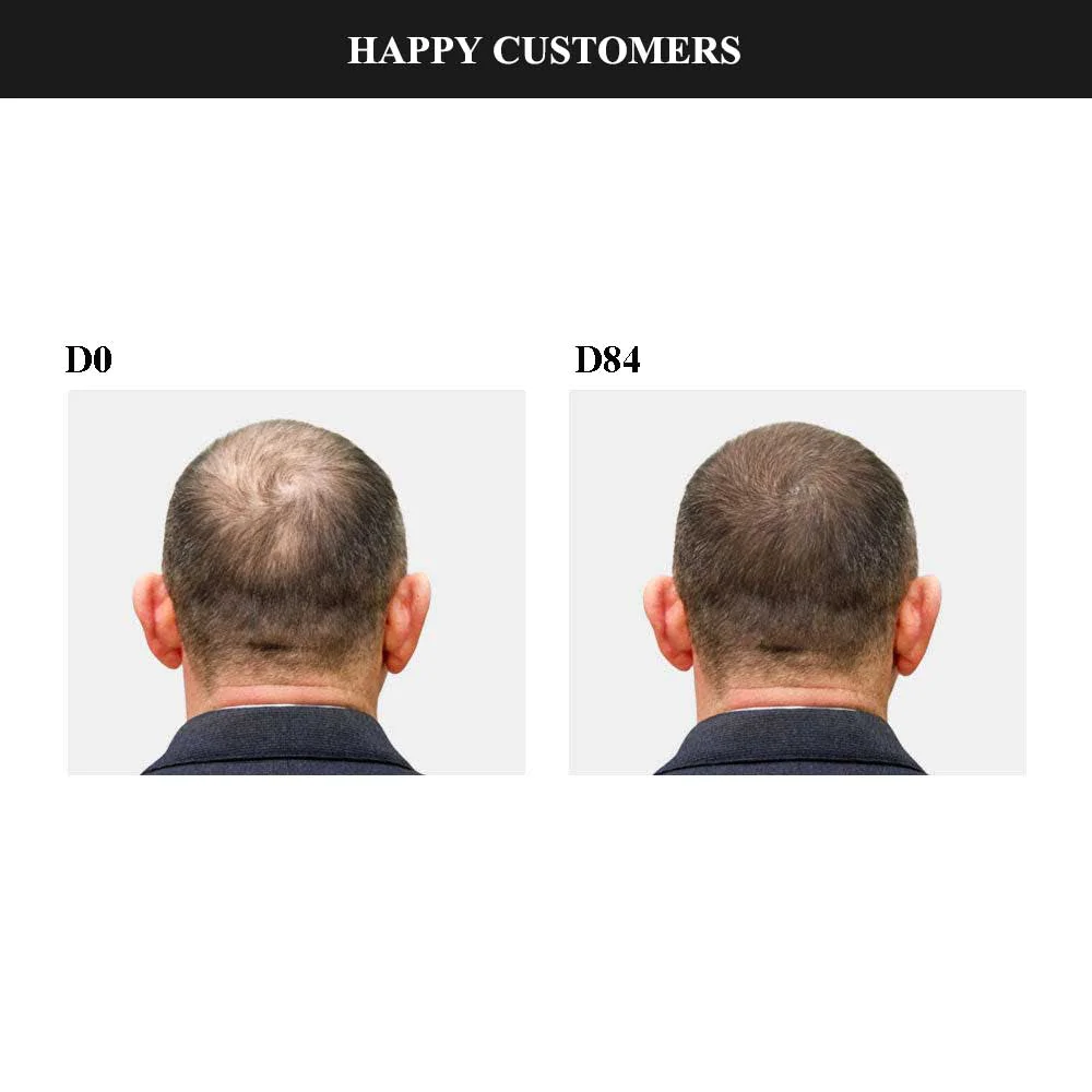 CKTUING HAIR GROWTH SERUM 2.0