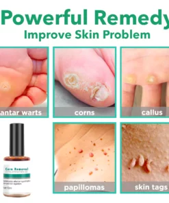 CornOff Extra Strengthen Gel