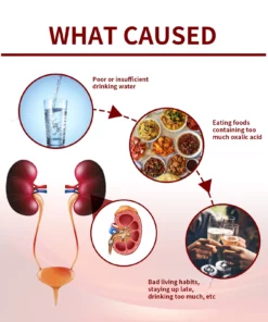 DcCare® End gout Break Down Kidney Stones Kidney Care Patch