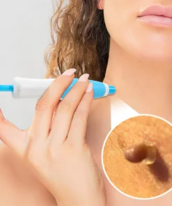 FibrOUT Auto Skin Tag Removal Kit