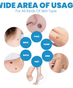 FibrOUT Auto Skin Tag Removal Kit