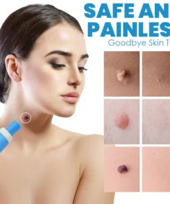 FibrOUT Auto Skin Tag Removal Kit