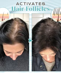 GINGRO™ Anti-Loss Hair Serum Spray