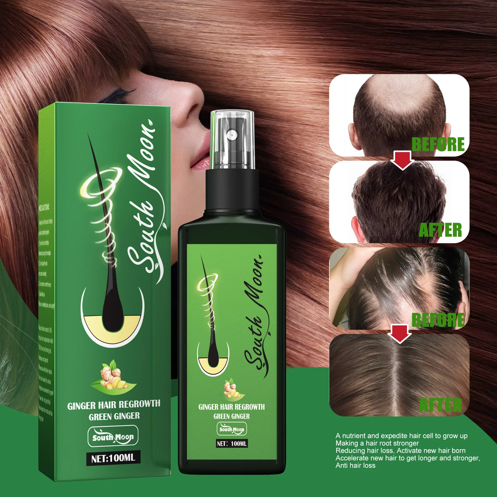 GrowthPlus Jaysuing Hair Spray - ultimate solution” for hair loss - Wowelo  - Your Smart Online Shop