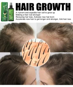 GrowthPlus Jaysuing Hair Spray