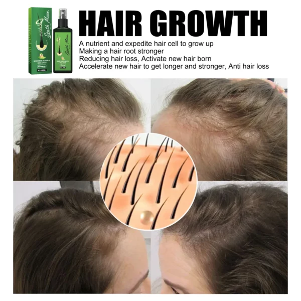 GrowthPlus Jaysuing Hair Spray