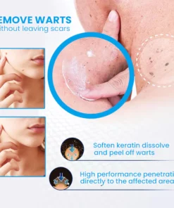 Instant Wart Removal Ointment