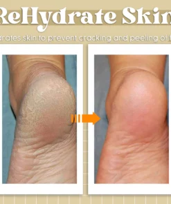 JaySuing™ Anti Fungal Treatment Spray